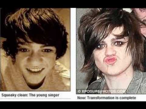 Frankie Cocozza's Massive Change??