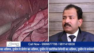 Rasoli ka durbeen ke operation se ilaaj