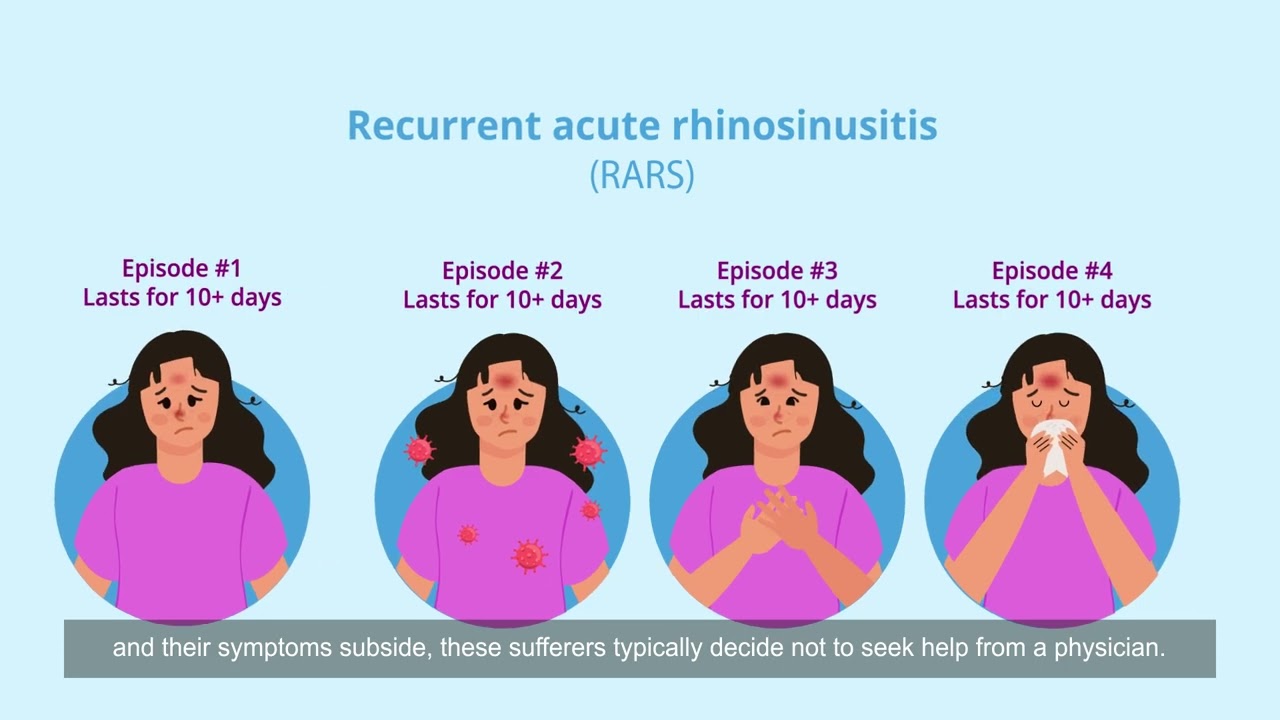 3) What type of sinusitis do I have?