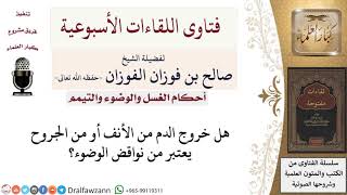 صورة هل خروج الدم من الأنف أو الجروح من نواقض الوضوء؟ لمعالي الشيخ صالح الفوزان