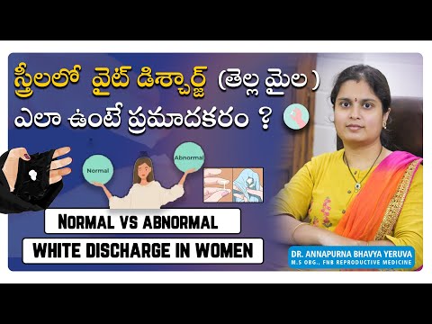 White discharge in women