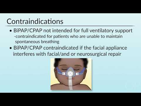 Non-Invasive Ventilation in the Non-ICU Setting by J. Gemignani, J. Rettig | OPENPediatrics