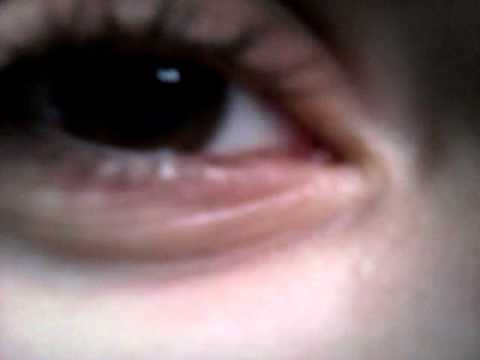 Horror-Auge