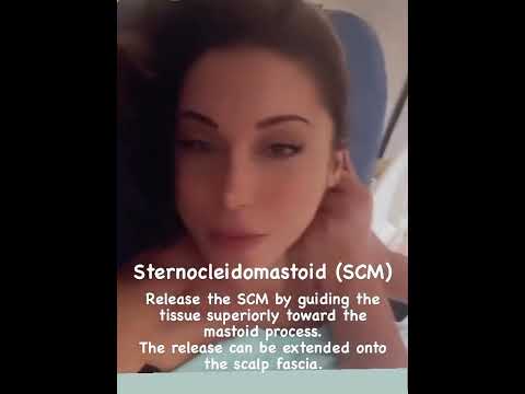Myofascial release for sternocleidomastoid