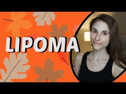 LIPOMA CAUSES, TREATMENTS, REMEDIES| Q&A WITH DERMATOLOGIST DR DRAY