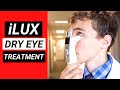 New Revolutionary Dry Eye Treatment - The iLux for Meibomian Gland Dysfunction (MGD)