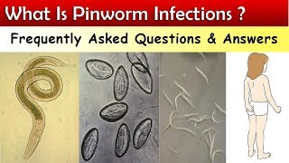 What Is Pinworm Infections ? ( FAQ & Answers )