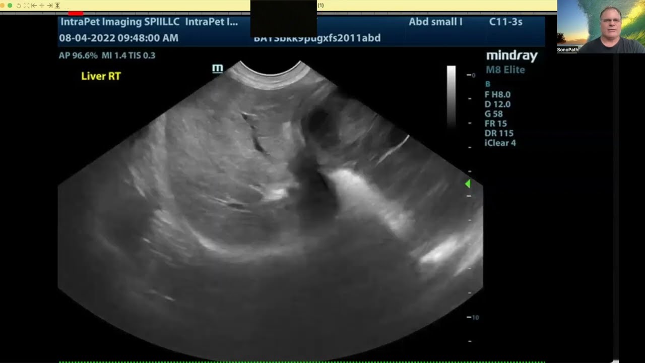 Just Put a Probe on It [5 Sono-Minutes with SonoPath [Ep.1]