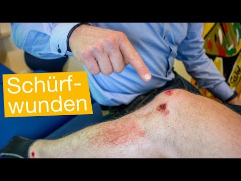 Rückenschmerzen Stillen Balsam für die Knochen und Gelenke