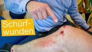 Schürfwunden behandeln ⚡️ Reinigen, Desinfizieren & Wundversorgung