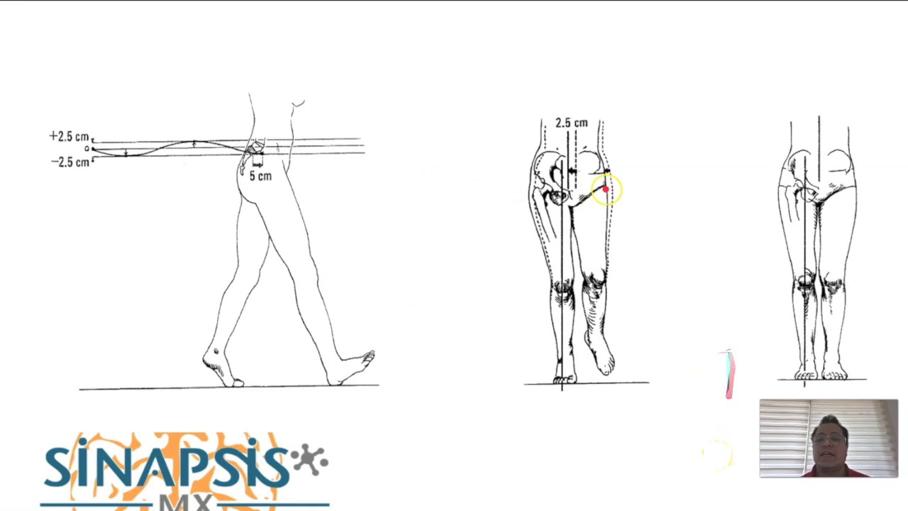 Trastornos de la marcha evaluación y diagnóstico