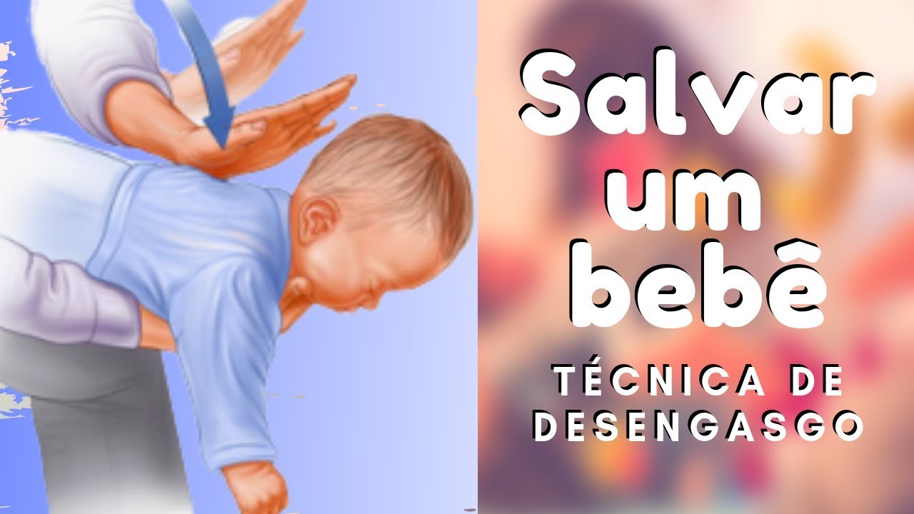 Desengasgar Bebê  1 ano, 2 anos (PRIMEIROS SOCORROS)  - Curso desengasgo de Bebês com segurança