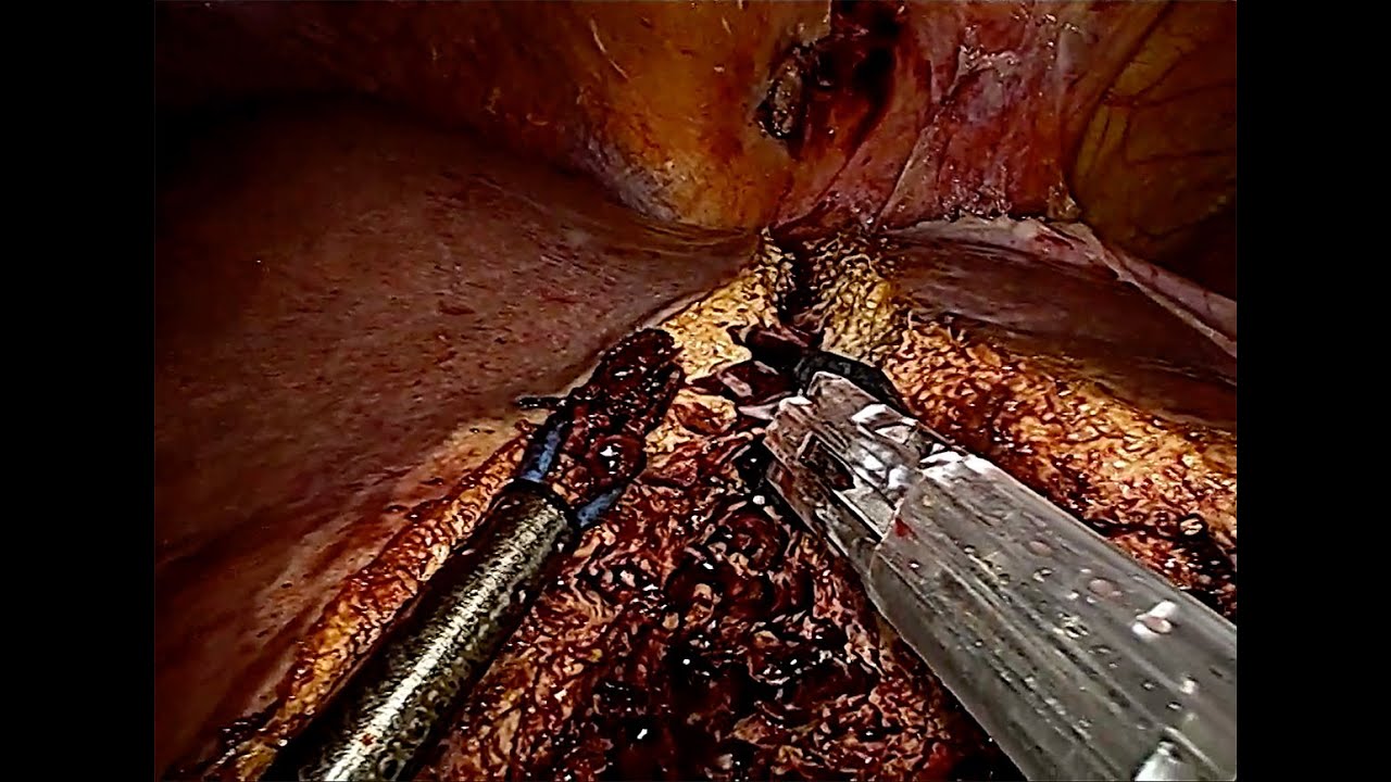 Michał Pędziwiatr-8