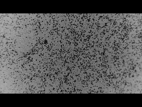 Local Coronavirus Update