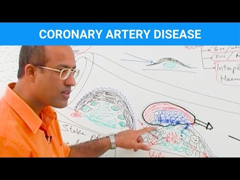 Coronary Artery Disease | Ischemic Heart Disease | Angina🫀