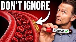 50% of Heart Attack Victims Had “Normal” Lab Results