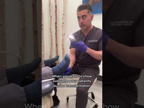 Bunion Doctor Just Wants To Show His Patients Transformations LOL