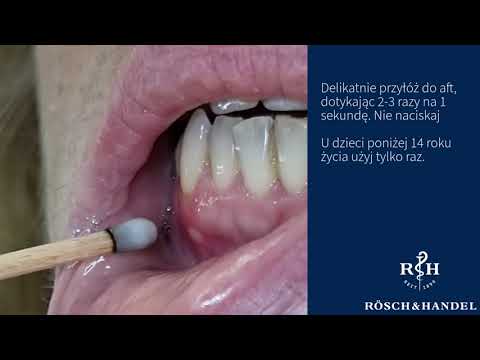 Jak szybko pozbyć się aft za pomocą patyczków SILVERIN® z azotanem srebra