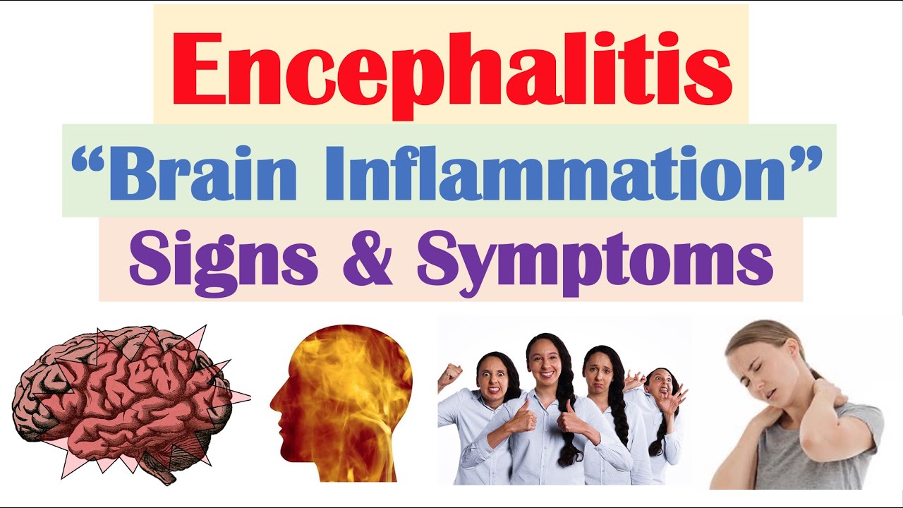 Encephalitis (“Brain Inflammation”) Signs and Symptoms (& Why They Occur)