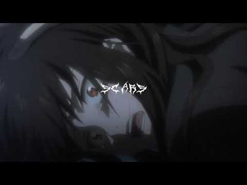 [FREE] SAD Post Malone x Lil Peep x Sonder Type Beat "ｅｎｄ  ｍｙ  ｌｉｆｅ" (prod.SCARS)