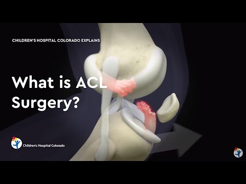 What is acl surgery?