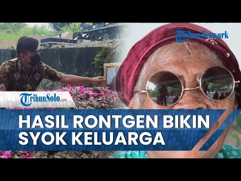 Detik-detik Mbah Minto Tutup Usia, Keluarga Syok, Ternyata Hasil Rontgen Almarhumah Seperti Ini
