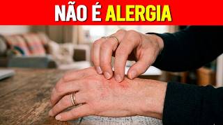 Dor no OMBRO DIREITO? O sinal de alerta que seu Fígado está parando