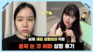 윤곽·눈·코에 이어… 이마까지 완성! 성형외과 직원의 리얼 성형 마지막 이야기 / 윤곽 + 눈 + 코 + 이마