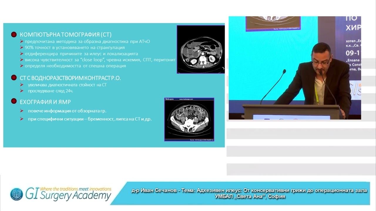 Adhesive Ileus: From Conservative Care to the Operating Room