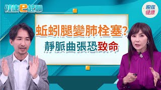 靜脈曲張放著不管恐截肢?!