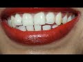 Zoom Camera Smile Most Request Video