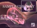 Childbirth Normal Vaginal Delivery