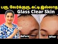 Just Do This And You Will Get Rid Of Pimples And Boils Prickly Heat Pimples Heat Boils Remedy