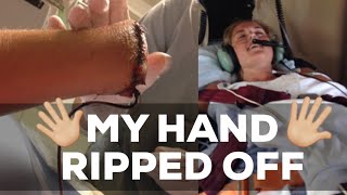 The Day I Almost Died | My Hand Ripped Off video