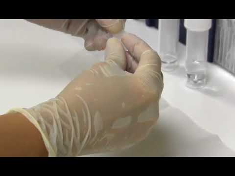 Preparing a cytology smear
