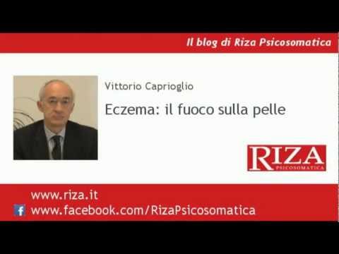 Unguento di prurito su eczema della pelle Cura di psoriasi camminatore rapido