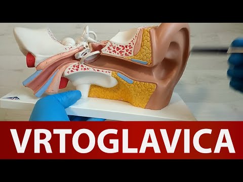 Razumijevanje uzroka vrtoglavice Dr#76