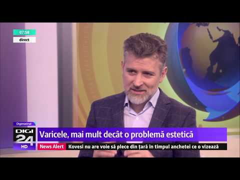 tratamentul osteochondrozei i varicozei