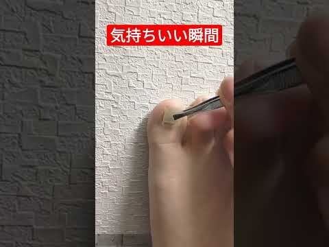 猫が爪で目を傷つけたのですが、どうすればよいですか?