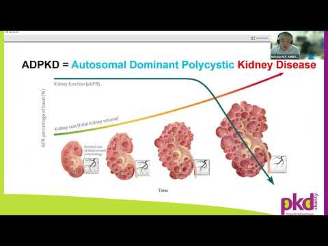 Video: ADPKD Basics: how ADPKD is diagnosed, its stages, and its causes by Dr Nicholas Annear