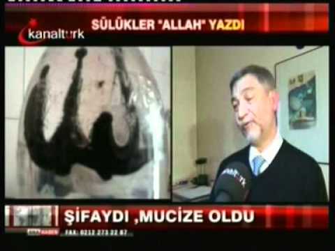 Sülük Tedavisi İle İlgili Haber ve Videolar