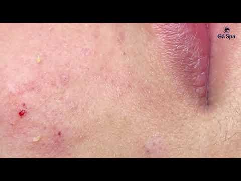 FULL BLACKHEAD | 21.04.2021