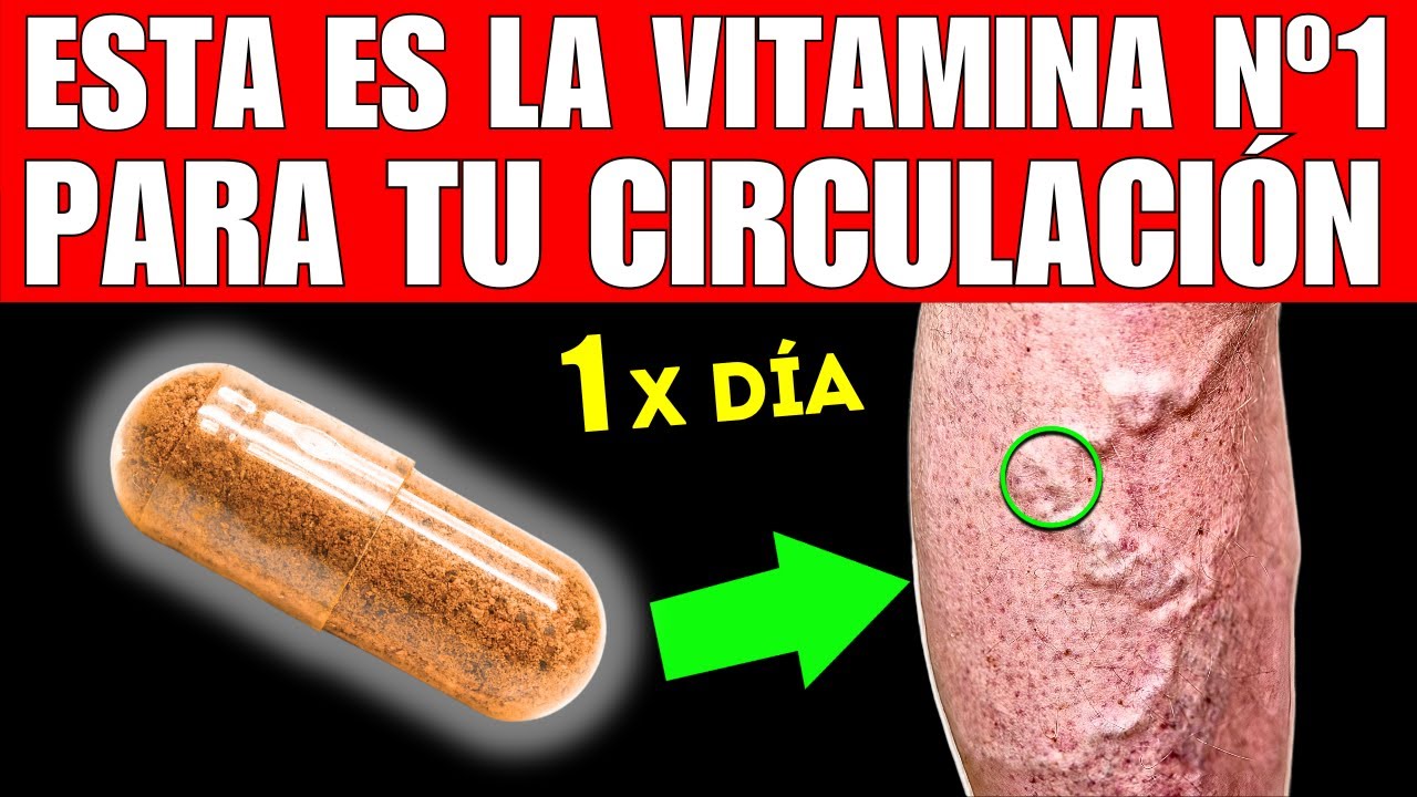 VITAMINA #1 que MEJORA la INSUFICIENCIA VENOSA (¡No Más VARICES!)
