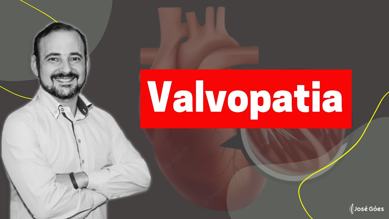 Valvopatia | José Góes