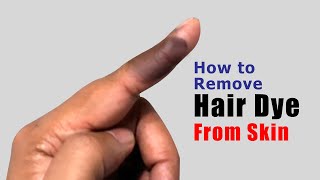 How to remove hair dye from skin | Easy & Effective Method