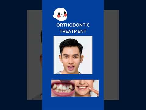 Orthodontics and health #dentaladvice #dentistnearme  #bestdentalclinic #hyderabad #braces