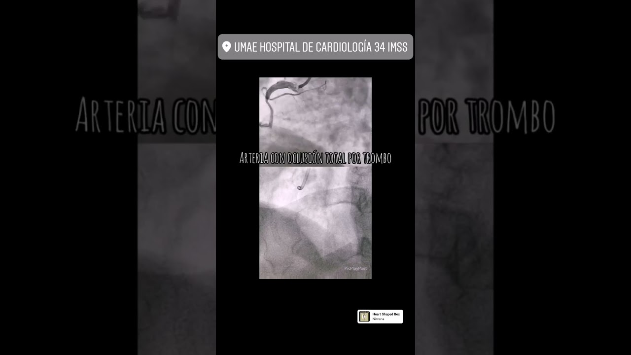 Antonio Covarrubias Gil-50