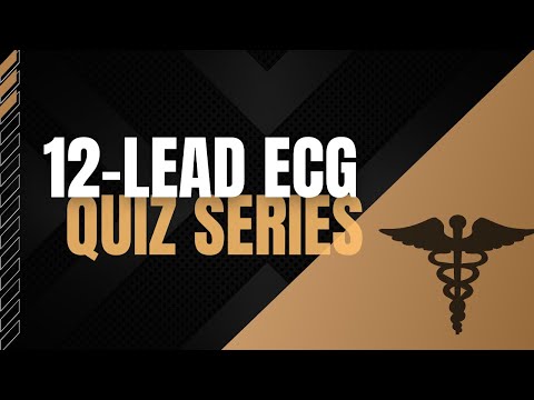 12-Lead ECG Quiz Series