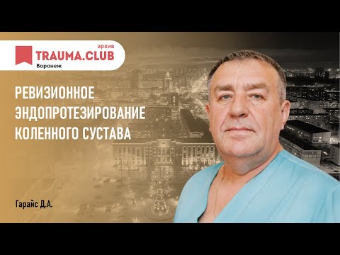 Ревизионное эндопротезирование коленного сустава.