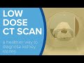 Low Dose CT Scan to Detect Kidney Stones